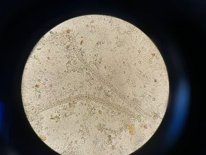 Strongyloides stercoralis
