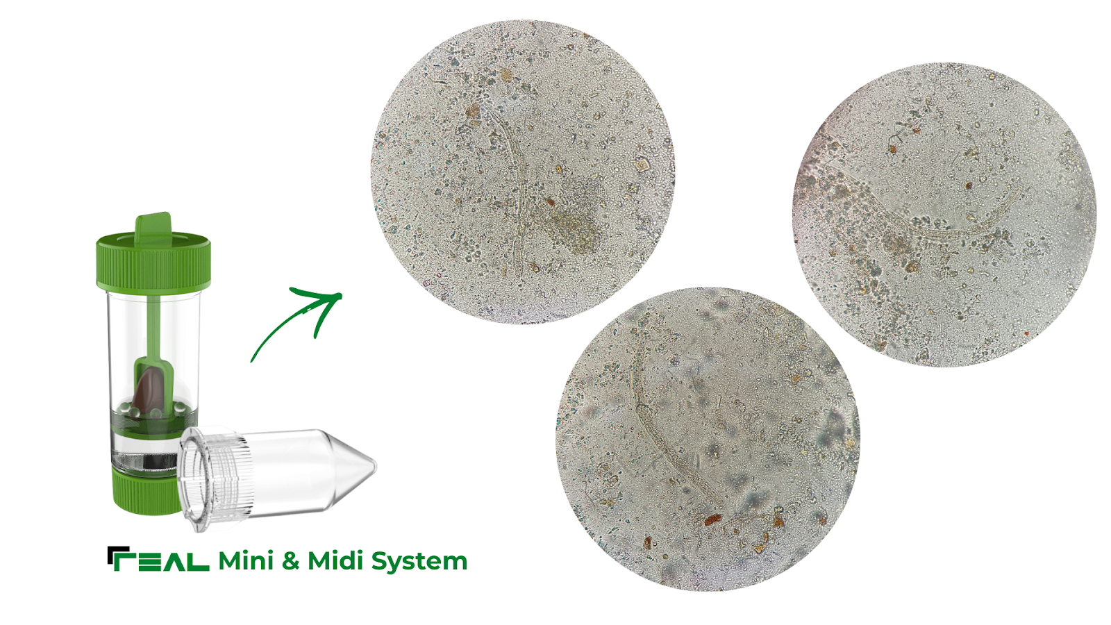 Diagnóstico de Strongyloides stercoralis sin Lugol