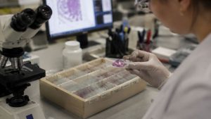 ¿Cómo ayuda la tecnología single-cell al estudio del cáncer?